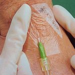 Medicazione 3M TEGADERM™ - 6 x 7 cm. - sterile - Cf. 100 pz.