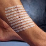 Cerotti 3M STERI-STRIP™ STRISCE PER SUTURA – 6 x 100 mm.  cf. 500 pz. (50 buste da 10 pz.)