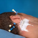 34946_b Medicazione 3M TEGADERM™ IV STRIPS - 8.5 x 10.5 cm. - sterile - per linee centrali - cf. 50 pz.