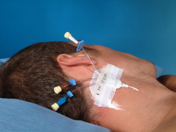 34946_b Medicazione 3M TEGADERM™ IV STRIPS - 8.5 x 10.5 cm. - sterile - per linee centrali - cf. 50 pz.