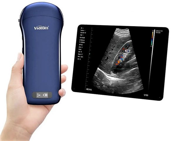 33934_a Ecografo portatile WIRELESS VIATOM 3 IN 1 - LINEARE/CONVESSO/CARDIACO