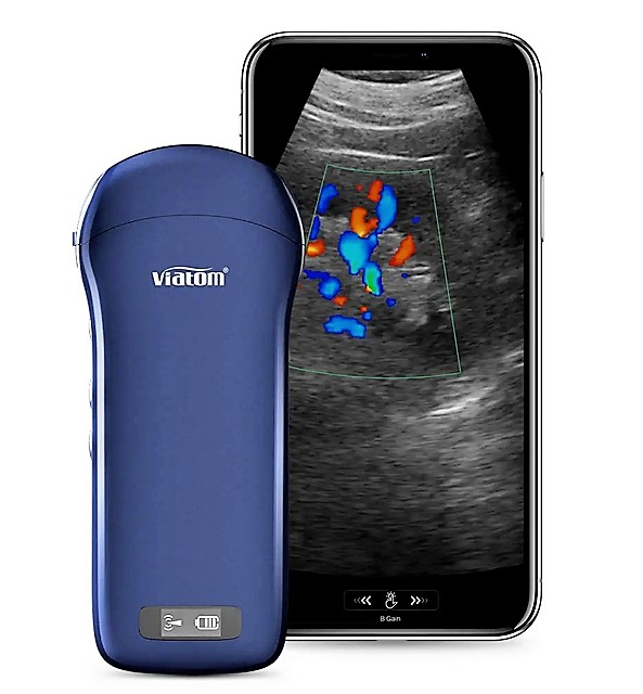 33934_b Ecografo portatile WIRELESS VIATOM 3 IN 1 - LINEARE/CONVESSO/CARDIACO