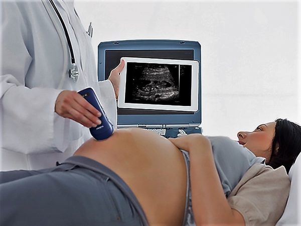 33934_d Ecografo portatile WIRELESS VIATOM 3 IN 1 - LINEARE/CONVESSO/CARDIACO