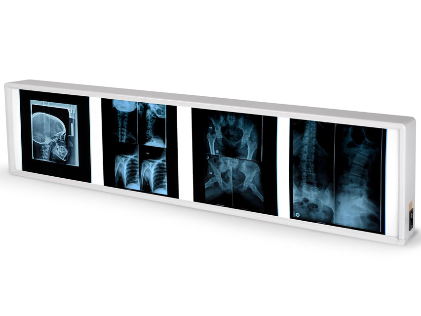 27368_a NEGATIVOSCOPIO QUADRUPLO 38 x 153 cm.