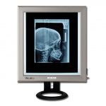 44705 TORINOMED - NEGATIVOSCOPIO ULTRAPIATTO DA TAVOLO LED - 42x36 cm.