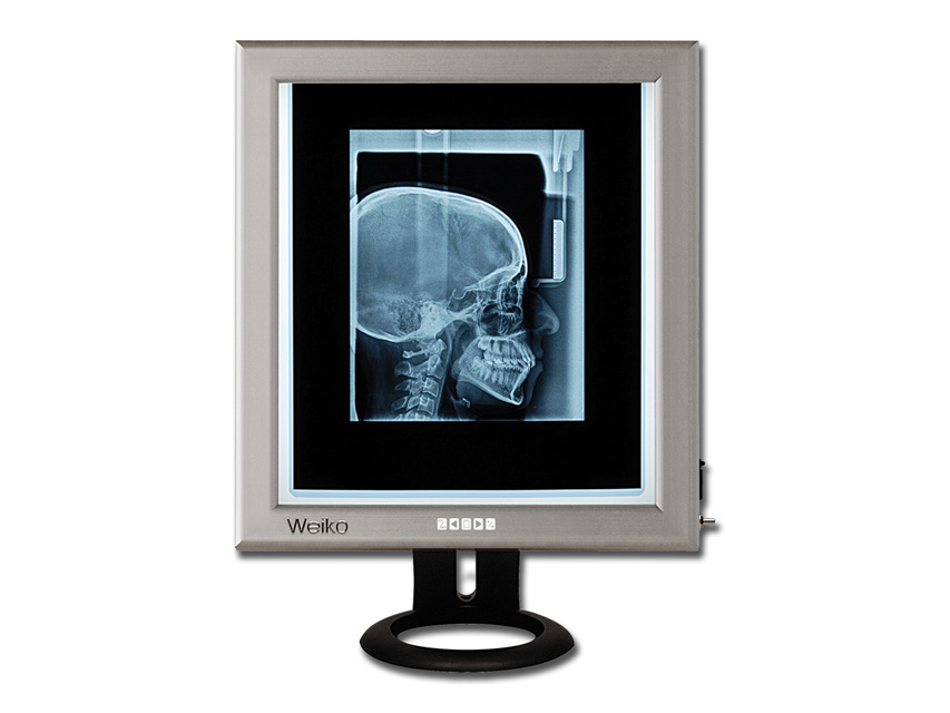 44705 TORINOMED - NEGATIVOSCOPIO ULTRAPIATTO DA TAVOLO LED - 42x36 cm.