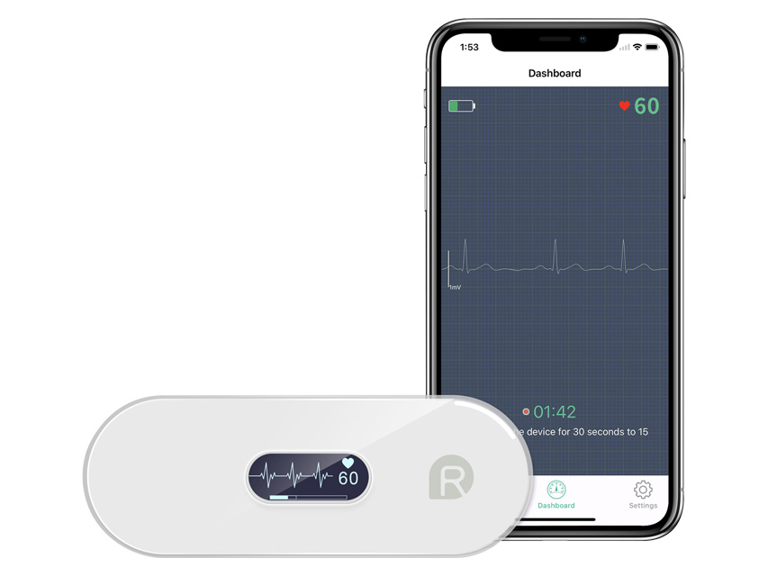 MONITOR ECG PORTATILE DUOEK S - TORINOMED