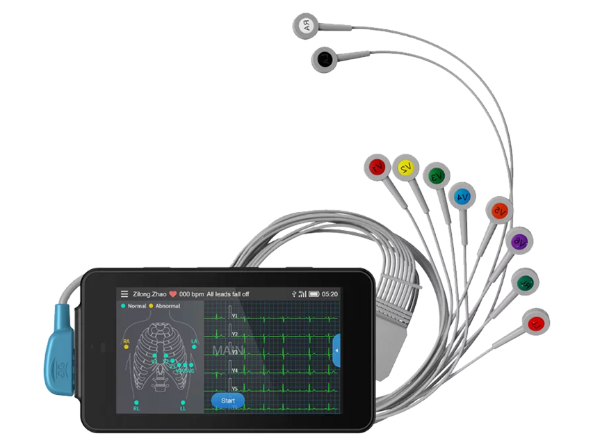 MONITOR ECG TASCABILE PCECG-500 MONITOR ECG TASCABILE PCECG-500 - TORINOMED