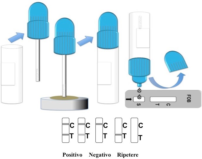 TEST FOB-SANGUE OCCULTO FECI-ESECUZIONE TEST TEST FOB-SANGUE OCCULTO FECI-ESECUZIONE TEST - TORINOMED