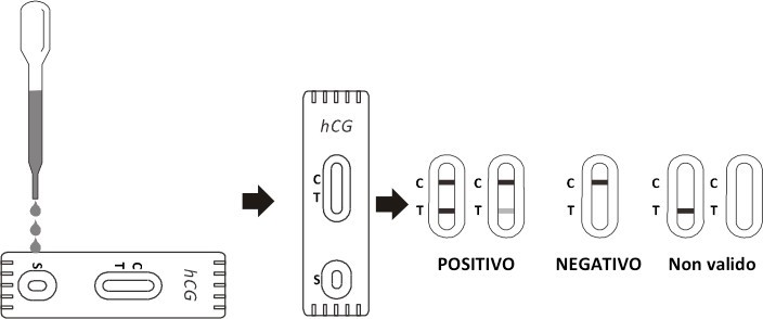 TEST HCG - GRAVIDANZA TEST HCG - GRAVIDANZA -TORINOMED