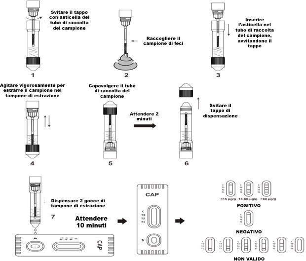 CALPROTECTICA RAPID TEST TEST CALPROTECTINA - CF 10 TEST